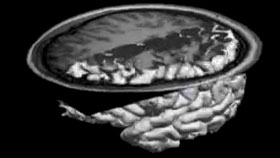 II. Self Came to Mind still - links to QuickTime movie